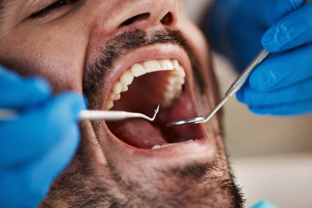 Best Cracked Tooth Emergency Dentist  in Moxee, WA